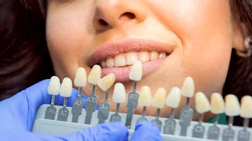 Best Teeth Whitening Durham Region