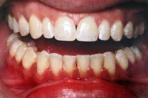 Braces & Clear Aligners Dentists Oshawa Ontario