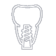 Restorative Dentistry Services Oshawa, ON